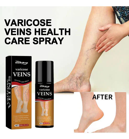 BEE VENOM VARICOSE VEINS RELIEF SPRAY