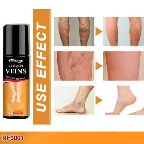 BEE VENOM VARICOSE VEINS RELIEF SPRAY